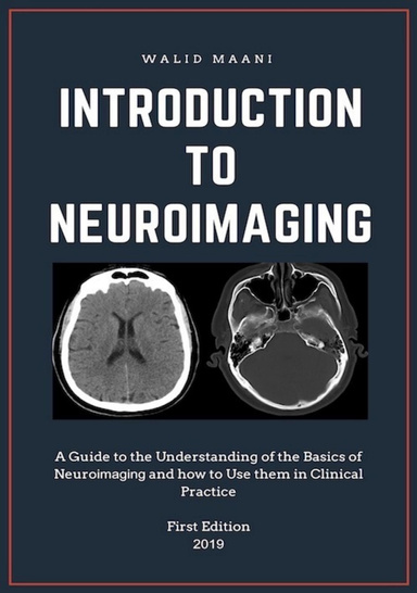 Introduction to Neuroimaging