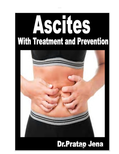 Ascites With Treatment and Prevention