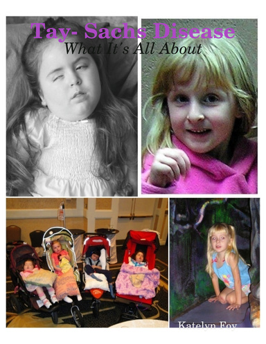 Tay- Sachs Disease: What It's All About