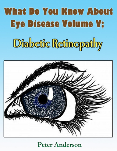 What Do You Know About Eye Disease Volume V;: Diabetic Retinopathy