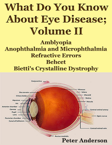 What Do You Know About Eye Disease; Volume II: Amblyopia, Anophthalmia and Microphthalmia, Refractive Errors, Behcet and Bietti's Crystalline Dystrophy