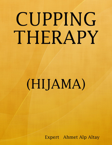 cupping therapy