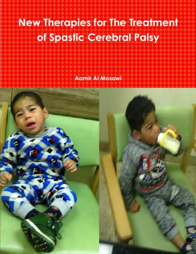 New Therapies for The Treatment of Spastic Cerebral Palsy