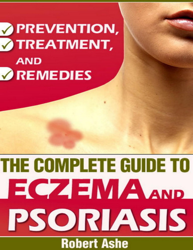 The Complete Guide To Eczema And Psoriasis - Prevention, Treatment and Remedies