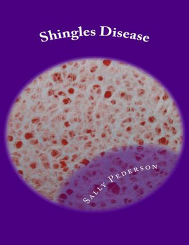 Shingles Disease