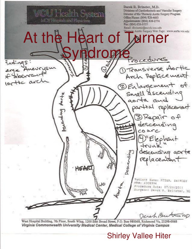At the Heart of Turner Syndrome