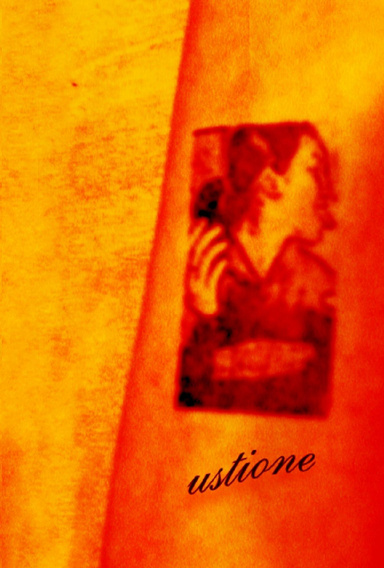 Ustione