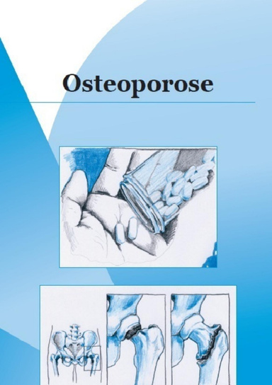 Osteoporosis (Danish version)
