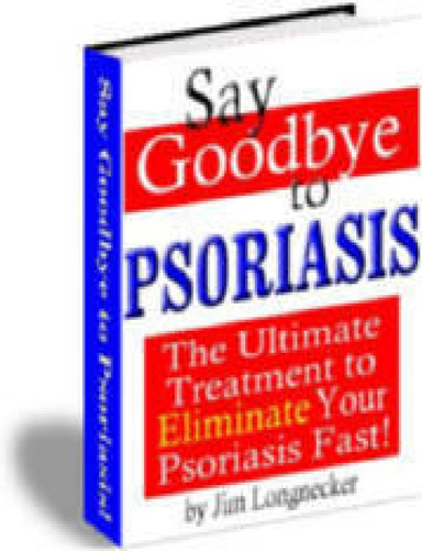 Say Goodbye to Psoriasis