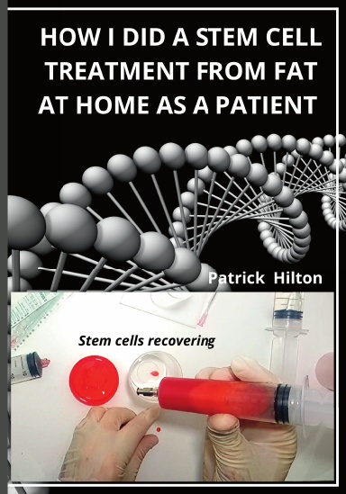HOW I DID A STEM CELL TREATMENT FROM FAT AT HOME AS A PATIENT