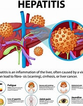 Aids and Hepatitis