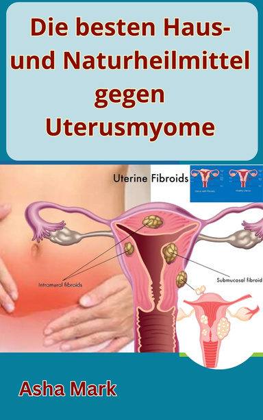 Die besten Haus- und Naturheilmittel gegen Uterusmyome