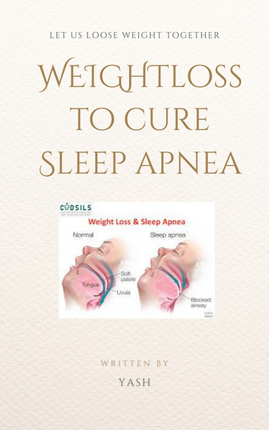 Weight loss for sleep apnea