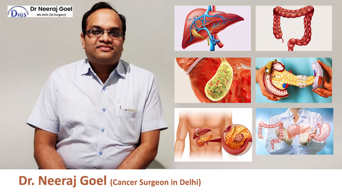 Leading Cancer Specialist Delhi
