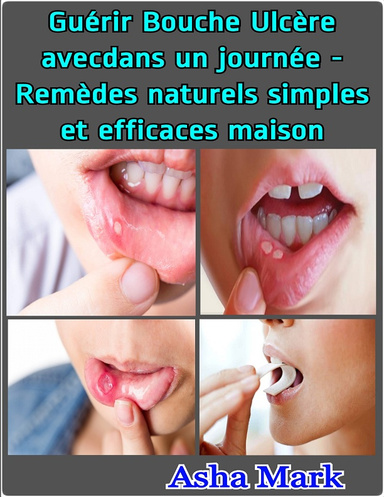Guérir Bouche Ulcère avecdans un journée - Remèdes naturels simples et efficaces maison