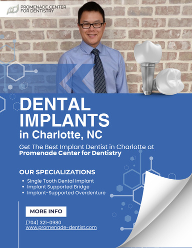 Dental Implants in Charlotte, NC by Promenade Center for Dentistry