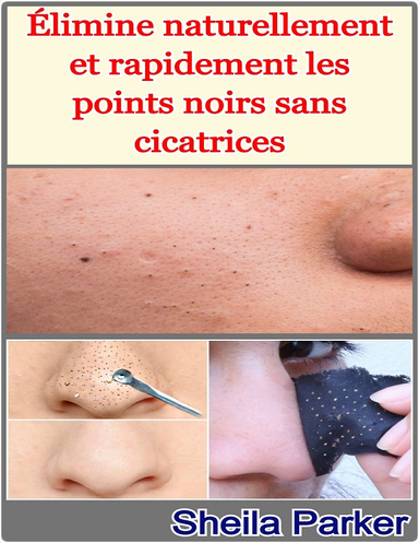 Élimine naturellement et rapidement les points noirs sans cicatrices