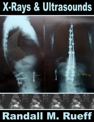 X-Rays & Ultrasounds