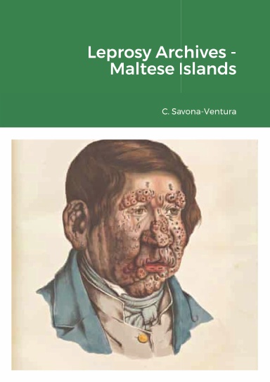 Leprosy Archives - Maltese Islands