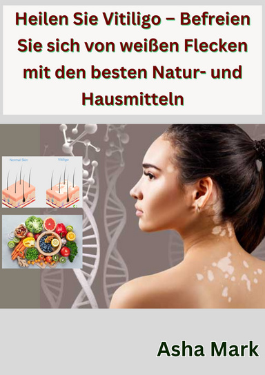 Heilen Sie Vitiligo – Befreien Sie sich von weißen Flecken mit den besten Natur- und Hausmitteln