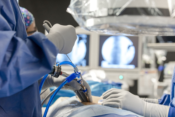 Endoscopic Spine Surgury in Pune.pdf