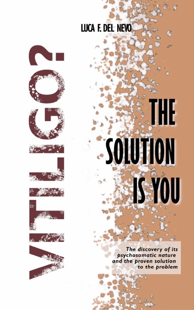 Vitiligo? The solution is you