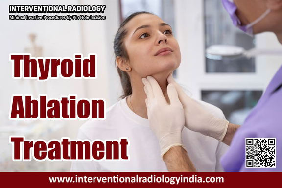 Thyroid Ablation Treatment in India: Leading the Way with Dr. Ajit Yadav