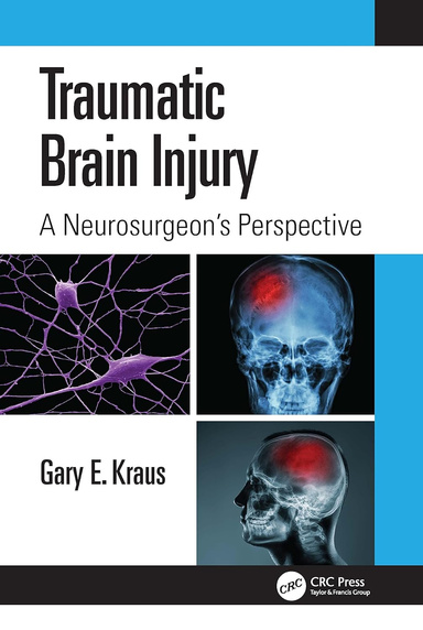 Traumatic Brain Injury: A Neurosurgeon's Perspective 1st Edition