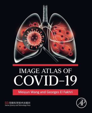 Image Atlas of COVID-19 1st Edition