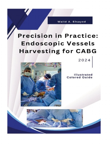 Precision in Practice: Endoscopic Vessel Harvesting for CABG
