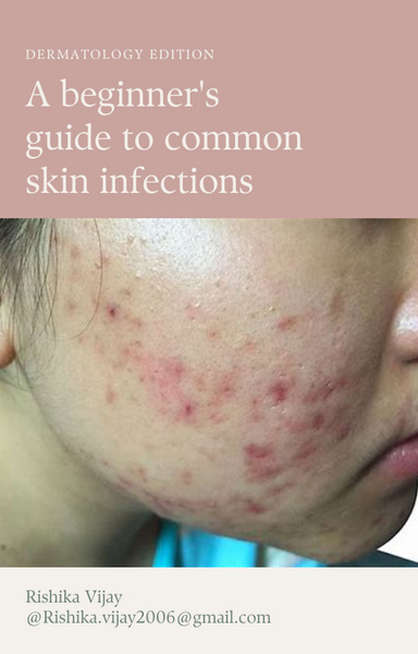 A beginner's guide to skin diseases