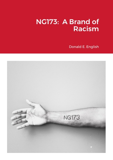 NG173: A Brand of Racism