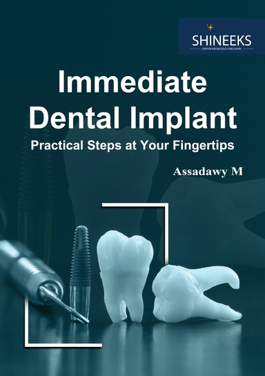 Immediate Dental Implant (Practical Steps at Your Fingertips)