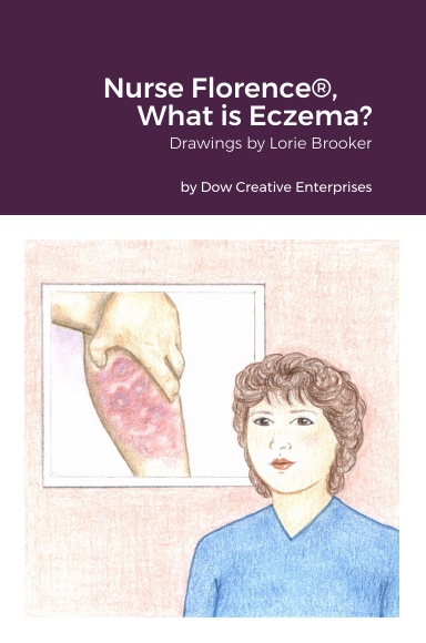 Nurse Florence®, What is Eczema?