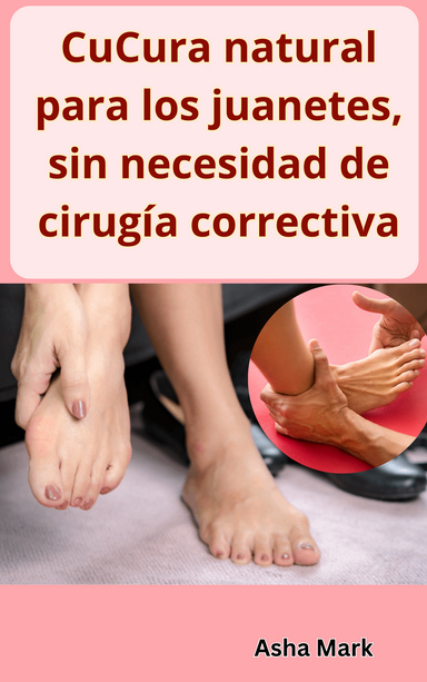 Cura natural para los juanetes, sin necesidad de cirugía correctiva