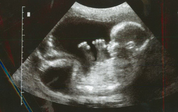 Pro-life and Texas laws