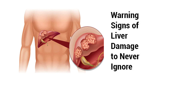 5 Warning Signs Your Liver Could Be Causing You Problems
