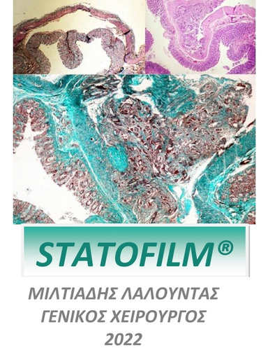 Statofilm