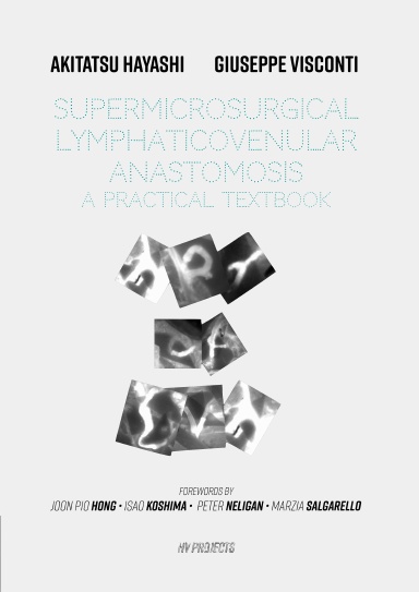 Supermicrosurgical LymphaticoVenular Anastomosis: A Practical Textbook.