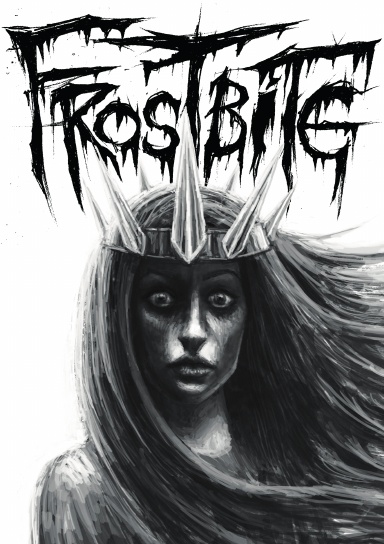 Frostbite