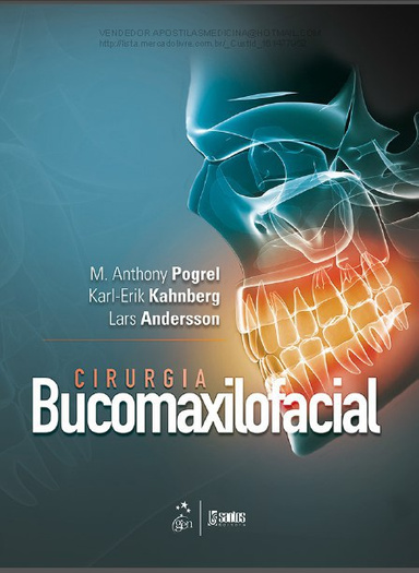 Cirurgia Bucomaxilofacial - Pogrel Kahnberg