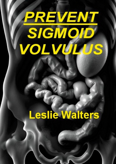 Prevent Sigmoid Volvulus