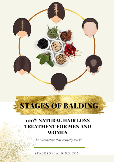 Stages of Balding Treatment