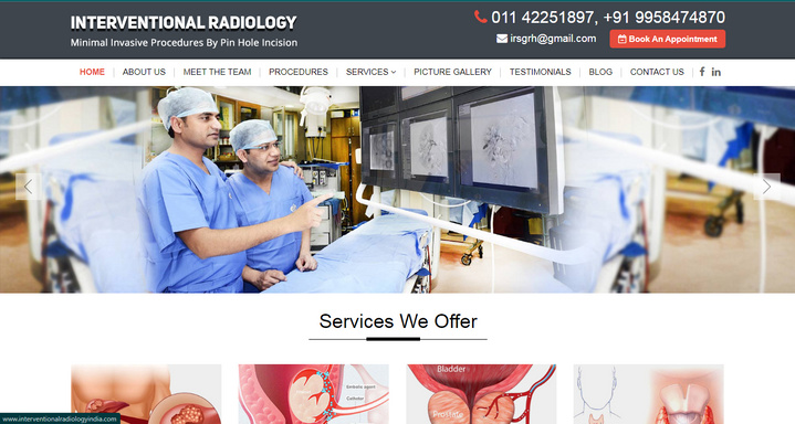 Uterine fibroid treatment in Delhi