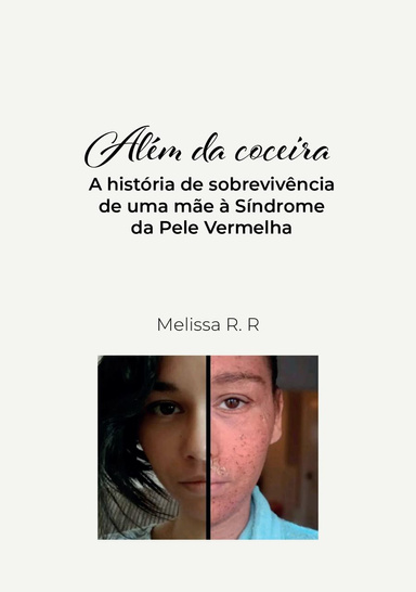 Além da coceira