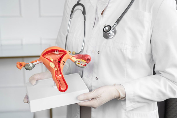 Uterine Fibroid Treatment in Delhi: Minimally Invasive Options for You