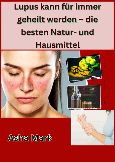 Lupus kann für immer geheilt werden – die besten Natur- und Hausmittel