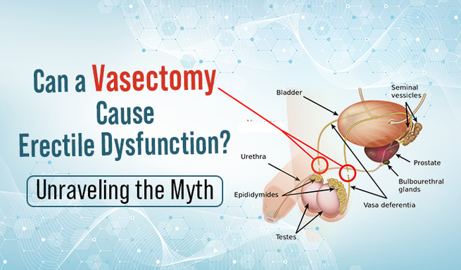 Vasectomy and Erectile Dysfunction: Debunking Myths