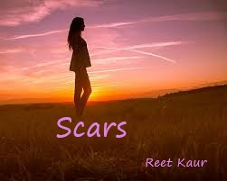 Scars