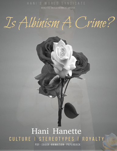 Is Albinism A Crime?